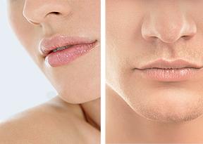 Lippen aufspritzen Bern | hautarzt-bubenberg.ch Je ein Bild einer Frau und eines Mannes mit aufgespritzten Lippen | hautarzt-bubenberg.ch